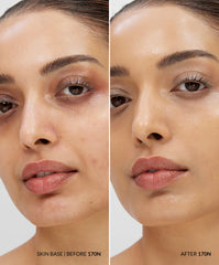 The Skin Base Set